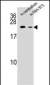 RAB12 Antibody (N-term)